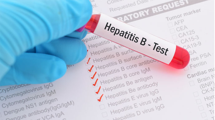 Ilustrasi Hepatitis Akut